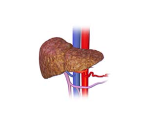 Liver Disease