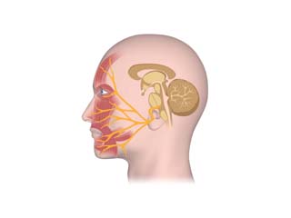 Atypical Facial Pain