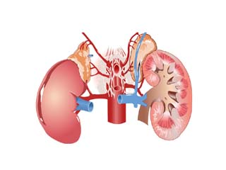 Kidney disease