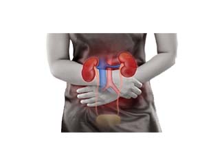 Kidney failure