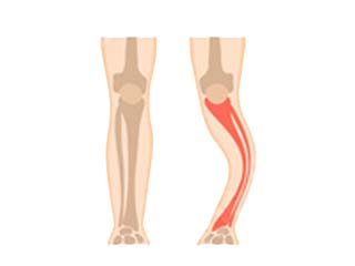 Orthopedic disease