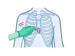 Physiotherapy disease