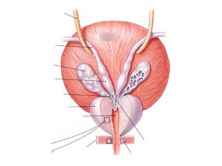 Urology disease