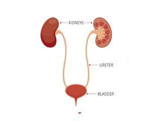 Urology disease