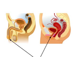 Urology disease