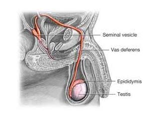 Urology disease